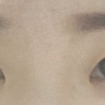 쌍액<b>전후</b> 심함?