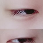 [댓글부탁해] 쌍수할까 댓글 ㄱㄱ