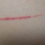 약혐...? 나 허벅지에 상처<b>난거</b> 일케됨 ㅜㅜ