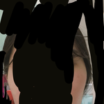 광대 많이<b>심해</b>?
