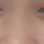 나 <b>눈밑</b> 지방 개쩌는데 어얌