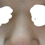 [조언부탁해] 애들아 나 <b>코</b> 어떡해 ;;