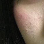 2주동안 <b>야채</b>먹고 피부좋아진후기