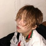 [댓글부탁해] 아토피<b>흉터</b>없어졋는데  졸라행복힘