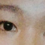 [이것좀봐줘] 이마보톡스맞고 <b>눈매</b>가변했어 ㅜ ㅜ