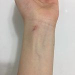 [댓글부탁해] <b>손목</b>에 이런상처 있으면 어때?