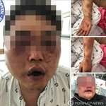 광주 폭행.이슈 국민청원 등장.