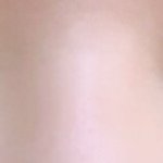 [꼭조언부탁] [조언부탁해]<b>쌍수</b>할까말까