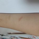 [댓글부탁해] 이거 <b>자해</b>같아?
