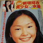 [댓글부탁해] <b>성형강국</b> 일본! <b>성형</b>기술 ㅆㅅㅌㅊ