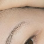 [댓글부탁해] <b>내</b> <b>눈</b> 어떰!????????? 성형할거임