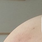 [댓글부탁해] 엉덩이 나처럼 <b>착색</b>된사람 있냐