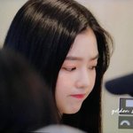 [댓글부탁해] 겨털제모후에 따가울때 어<b>캐해</b>??