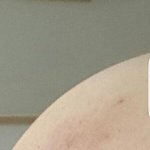 [댓글부탁해] 내 엉덩이 어떡함????