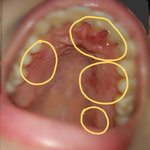 +수정, 2차 추가) 센*** 치약 부작용