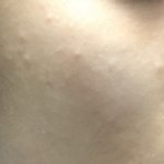[댓글부탁해] 이거 컨실러로 커버 가능해?