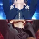 [드루와] 남초를 뒤흔든 <b>엑소백현</b> 턱성형 부작용