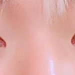 [EXO] 백현 <b>쌍수</b> 너무 <b>티</b>난다