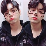 [조언부탁해] 피부 <b>탄지</b> 4일 지났는데