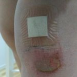 약혐)이거 <b>진물</b> 어떻게 해?ㅠㅠ