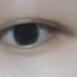 쌍수 <b>절개</b> 4개월찬데