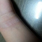 [드루와] <b>사진o</b>))자해하는 애들아