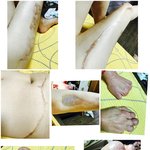 하나의 실수로 손가락과 발가락을 절단하신 저희어머니를 도와주세요...