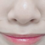 <b>팔자</b>주름 왜이래