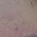 [댓글부탁해] 얘들아 나 <b>피부</b> <b>개</b>쓰레기인데 어떡해?