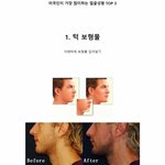 [고급진] <b>동서양</b>의 성형