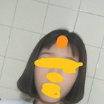 나 피부완전애기피<b>부임</b>