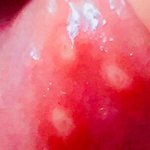 내 구내염 <b>시밤</b> 혐짤일 수도