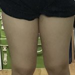 [댓글부탁해] 2주뒤에 <b>허벅</b>지살 얼마나 빠질까