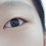 [꼭봐주세요] 완전 다른 <b>쌍테</b> 전후 보여줄께