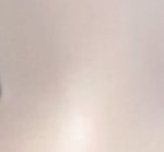 쌍수한뒤로 라인망하고 눈매과교정되고 몽고<b>주름</b>생김