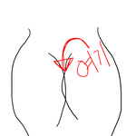 [댓글부탁해] 아니 엉덩이에 이런거 나면 어케 함??