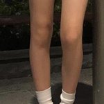 [조언부탁해] 나 너무 말라서 걱정이야