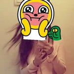 [꼭조언부탁] 갑상선때문에 살이 너무 쪄요(사진ㅇ)