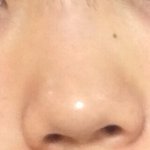 코<b>쉐딩</b>전후