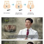 [명랑엽떡] 반복적으로 <b>비데</b>를 쓰면