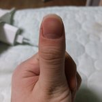 나보다 엄지<b>손톱</b> 큰사람,,,