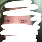 쌍수 절개로 할까 <b>매몰</b>로 할까ㅜㅜㅜ