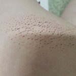 [19] 약혐)애들아나허벅지에이상한<b>흉터</b>