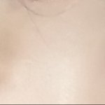 무쌍인데..쌍수할까??