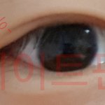 쌍수했는데 눈 <b>뒷부분</b> 이거 왜이럼 ㅠ