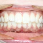 [개깊은빡침] 환자를 돈으로만 보는 먹튀/이벤트 병원, 우리나라는...