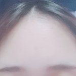 [조언부탁해] <b>이마</b> 좁아지는방법없음??ㅠㅠㅠ