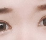 [댓글부탁해] (<b>사진o</b>) 나 쌍수 전후 개쩜