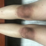 탈<b>색약</b> 피부에 묻어보신분잇나요...