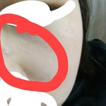 눈 <b>밑</b>에.이런<b>주름</b> 왜생기는거야ㅜㅜㅜ